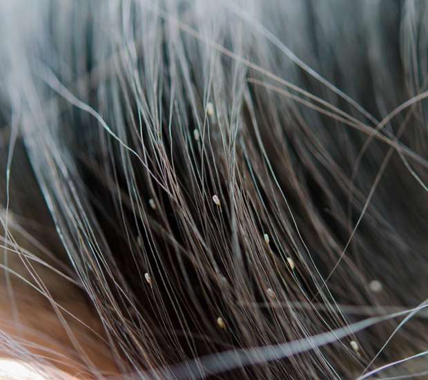 Lice Infestation Treatment Fort Lauderdale, FL Proactive Medical